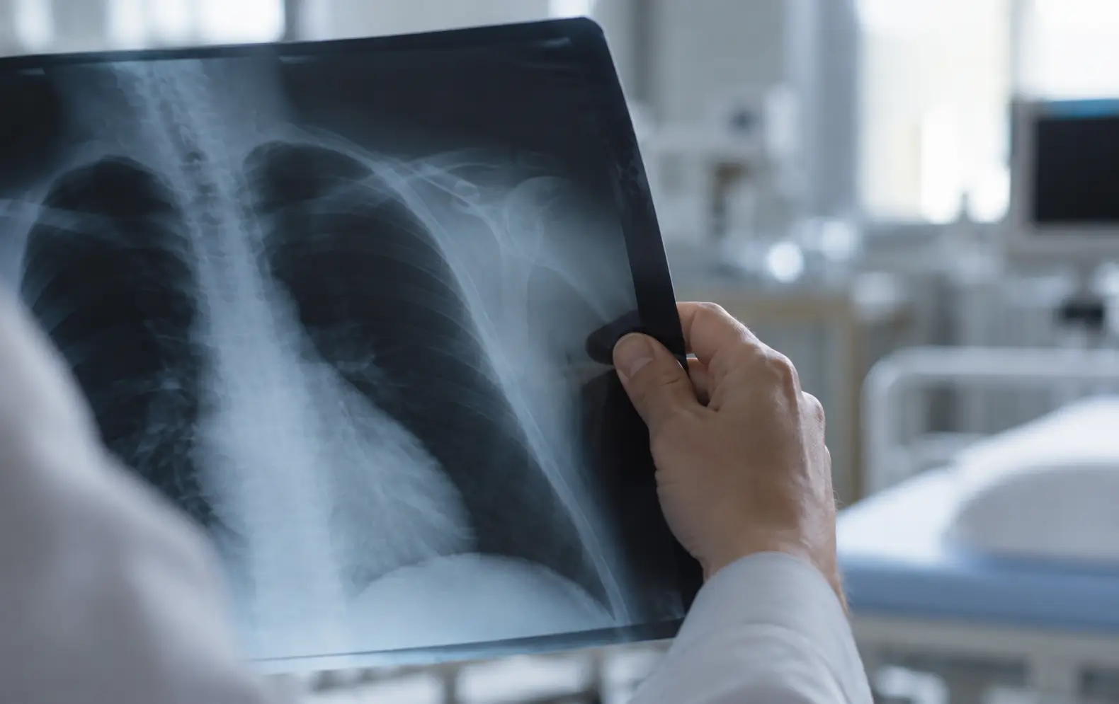 Medico che esamina una radiografia del torace in un ambiente clinico.